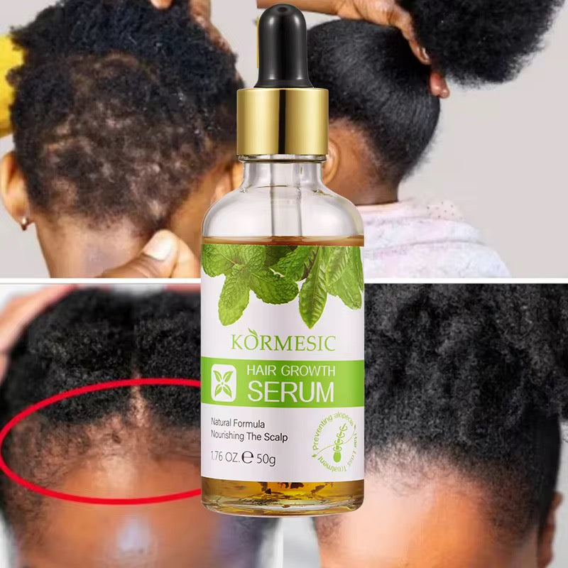 Sérum croissance cheveux