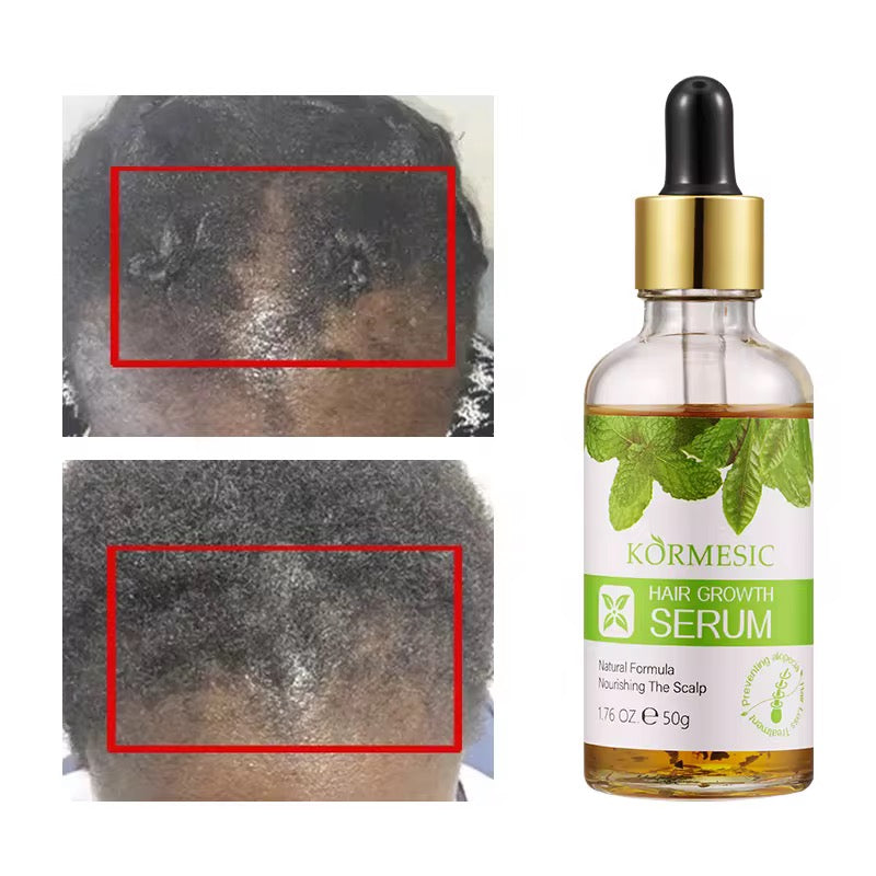 Sérum croissance cheveux